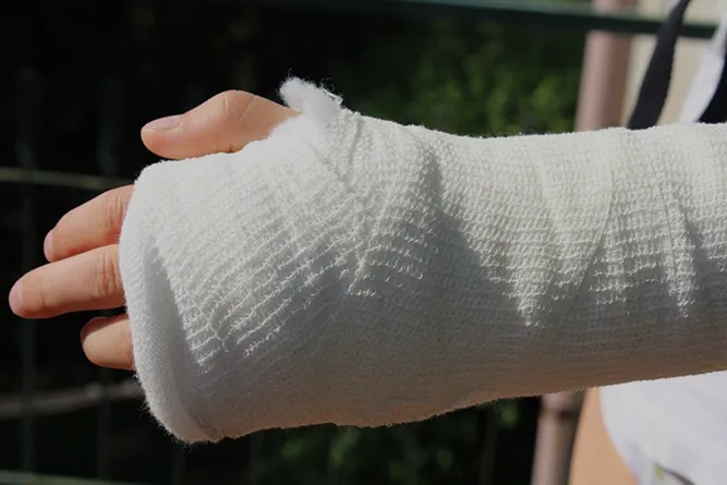 Fractura de Radio